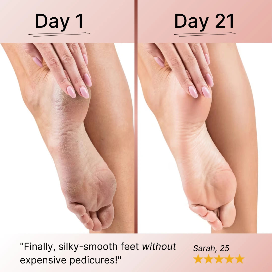 Electric Foot Callus Remover